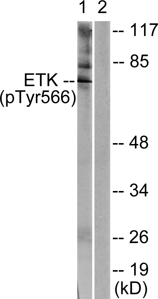 ETK / BMX Antibody - Western blot analysis of lysates from HeLa cells treated with Serum 20% 15', using ETK (Phospho-Tyr566) Antibody. The lane on the right is blocked with the phospho peptide.