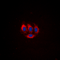 ETK / BMX Antibody - Immunofluorescent analysis of BMX (pY566) staining in HeLa cells. Formalin-fixed cells were permeabilized with 0.1% Triton X-100 in TBS for 5-10 minutes and blocked with 3% BSA-PBS for 30 minutes at room temperature. Cells were probed with the primary antibody in 3% BSA-PBS and incubated overnight at 4 deg C in a humidified chamber. Cells were washed with PBST and incubated with a DyLight 594-conjugated secondary antibody (red) in PBS at room temperature in the dark. DAPI was used to stain the cell nuclei (blue).