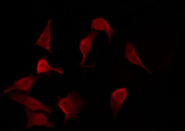 ETK / BMX Antibody - Staining HepG2 cells by IF/ICC. The samples were fixed with PFA and permeabilized in 0.1% Triton X-100, then blocked in 10% serum for 45 min at 25°C. The primary antibody was diluted at 1:200 and incubated with the sample for 1 hour at 37°C. An Alexa Fluor 594 conjugated goat anti-rabbit IgG (H+L) Ab, diluted at 1/600, was used as the secondary antibody.