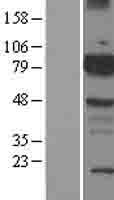 ETK / BMX Protein - Western validation with an anti-DDK antibody * L: Control HEK293 lysate R: Over-expression lysate