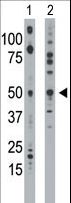 ETNK1 / Ethanolamine Kinase 2 Antibody - The anti-EKI1 antibody is used in Western blot to detect EKI1 in mouse bladder tissue lysate (Lane 1) and 293 cell lysate (Lane 2).