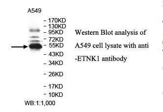 ETNK1 / Ethanolamine Kinase 2 Antibody