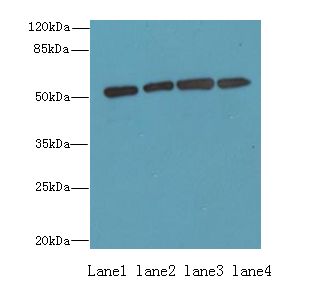 ETNK1 / Ethanolamine Kinase 2 Antibody - Western blot. All lanes: ETNK1 antibody at 0.5 ug/ml. Lane 1: A549 whole cell lysate. Lane 2: A431 whole cell lysate. Lane 3: HepG-2 whole cell lysate. Lane 4: MCF7 whole cell lysate. Secondary Goat polyclonal to Rabbit IgG at 1:10000 dilution. Predicted band size: 51 kDa. Observed band size: 51 kDa.
