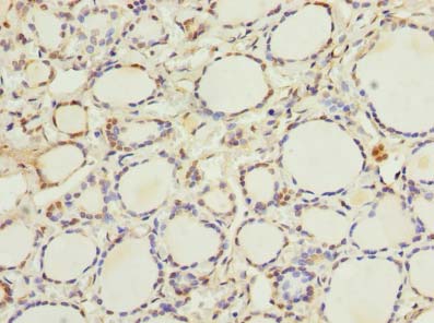 ETNK1 / Ethanolamine Kinase 2 Antibody - Immunohistochemistry of paraffin-embedded human thyroid tissue using antibody at dilution of 1:100.