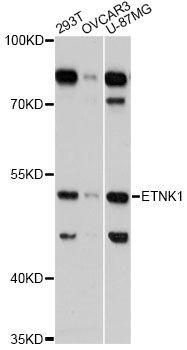 ETNK1 / Ethanolamine Kinase 2 Antibody - Western blot analysis of extracts of various cell lines, using ETNK1 Antibody at 1:3000 dilution. The secondary antibody used was an HRP Goat Anti-Rabbit IgG (H+L) at 1:10000 dilution. Lysates were loaded 25ug per lane and 3% nonfat dry milk in TBST was used for blocking. An ECL Kit was used for detection and the exposure time was 90s.