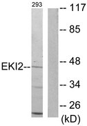ETNK2 Antibody - Western blot analysis of lysates from 293 cells, using EKI2 Antibody. The lane on the right is blocked with the synthesized peptide.