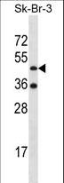 ETNK2 Antibody - ETNK2 Antibody western blot of SK-BR-3 cell line lysates (35 ug/lane). The ETNK2 antibody detected the ETNK2 protein (arrow).