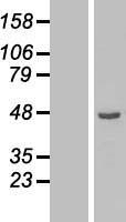 ETNK2 Protein - Western validation with an anti-DDK antibody * L: Control HEK293 lysate R: Over-expression lysate