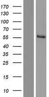 ETNPPL / AGXT2L1 Protein - Western validation with an anti-DDK antibody * L: Control HEK293 lysate R: Over-expression lysate
