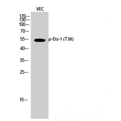 ETS1 / ETS-1 Antibody - Western blot of Phospho-Ets-1 (T38) antibody