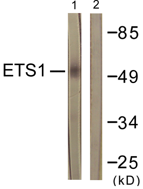 ETS1 / ETS-1 Antibody - Western blot analysis of lysates from HeLa cells, treated with Serum 20% 15', using ETS1 Antibody. The lane on the right is blocked with the synthesized peptide.