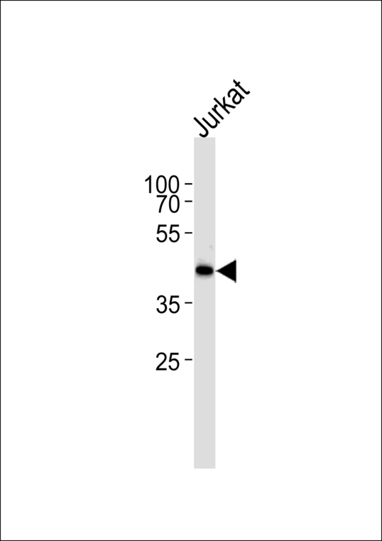 ETS1 / ETS-1 Antibody - Western blot of lysate from Jurkat cell line, using ETS1 Antibody. Antibody was diluted at 1:1000 at each lane. A goat anti-rabbit IgG H&L (HRP) at 1:5000 dilution was used as the secondary antibody. Lysate at 35ug.