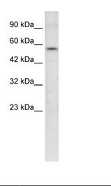 ETS1 / ETS-1 Antibody - HepG2 Cell Lysate.  This image was taken for the unconjugated form of this product. Other forms have not been tested.