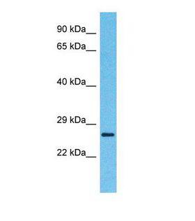 ETS1 / ETS-1 Antibody - Western blot of Human Thyroid tumor. ETS1 antibody dilution 1.0 ug/ml.  This image was taken for the unconjugated form of this product. Other forms have not been tested.