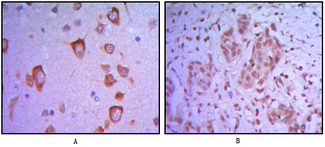 ETS1 / ETS-1 Antibody - IHC of paraffin-embedded human brain tissue (A) and breast tumor (B) using ETS1 mouse monoclonal antibody.