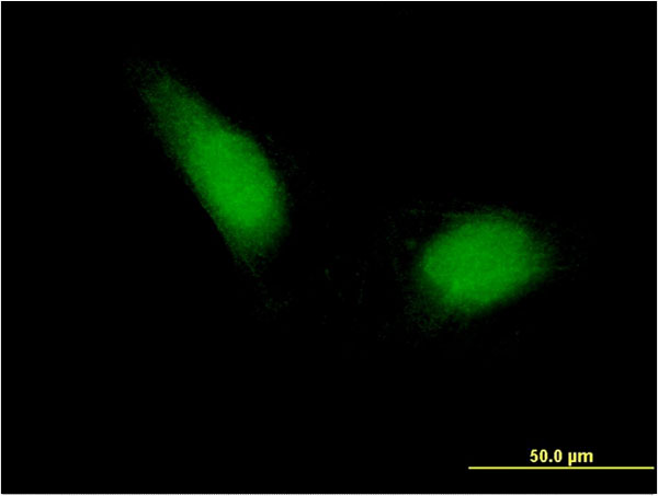 ETS1 / ETS-1 Antibody - Immunofluorescence of monoclonal antibody to ETS1 on HeLa cell . [antibody concentration 10 ug/ml]