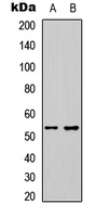 ETS1 / ETS-1 Antibody - Western blot analysis of ETS1 expression in HeLa (A); HEK293T (B) whole cell lysates.