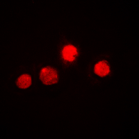 ETS1 / ETS-1 Antibody - Immunofluorescent analysis of ETS1 staining in HEK293T cells. Formalin-fixed cells were permeabilized with 0.1% Triton X-100 in TBS for 5-10 minutes and blocked with 3% BSA-PBS for 30 minutes at room temperature. Cells were probed with the primary antibody in 3% BSA-PBS and incubated overnight at 4 deg C in a humidified chamber. Cells were washed with PBST and incubated with a DyLight 594-conjugated secondary antibody (red) in PBS at room temperature in the dark. DAPI was used to stain the cell nuclei (blue).