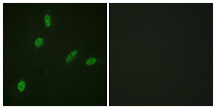 ETS1 / ETS-1 Antibody - Peptide - + Immunofluorescence analysis of HeLa cells, using ETS1 (Ab-38) antibody.