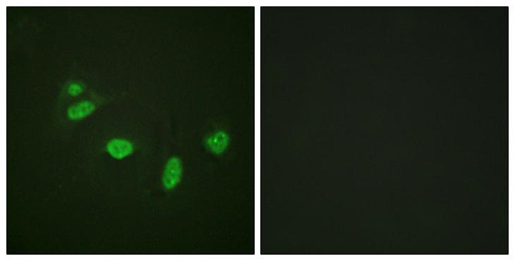 ETS1 / ETS-1 Antibody - Immunofluorescence analysis of HeLa cells, using ETS1 (Phospho-Thr38) Antibody. The picture on the right is blocked with the phospho peptide.
