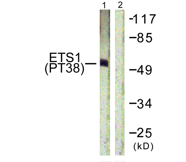 ETS1 / ETS-1 Antibody - Western blot analysis of lysates from HeLa cells treated with Serum 20% 15', using ETS1 (Phospho-Thr38) Antibody. The lane on the right is blocked with the phospho peptide.