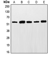 ETS1 / ETS-1 Antibody - Western blot analysis of ETS1 (pT38) expression in LO2 (A); Jurkat (B); HepG2 (C); NIH3T3 (D); rat liver (E) whole cell lysates.
