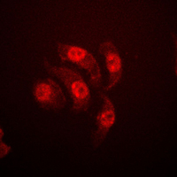 ETS1 / ETS-1 Antibody - Immunofluorescent analysis of ETS1 (pT38) staining in Jurkat cells. Formalin-fixed cells were permeabilized with 0.1% Triton X-100 in TBS for 5-10 minutes and blocked with 3% BSA-PBS for 30 minutes at room temperature. Cells were probed with the primary antibody in 3% BSA-PBS and incubated overnight at 4 C in a humidified chamber. Cells were washed with PBST and incubated with a DyLight 594-conjugated secondary antibody (red) in PBS at room temperature in the dark. DAPI was used to stain the cell nuclei (blue).