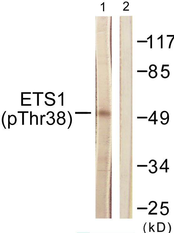 ETS1 / ETS-1 Antibody - Western blot analysis of extracts from HeLa cells, treated with Serum (20%, 15mins), using ETS1 (Phospho-Thr38) antibody.