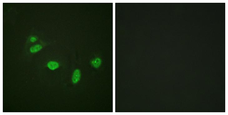 ETS1 / ETS-1 Antibody - P-peptide - + Immunofluorescence analysis of HeLa cells, using ETS1 (Phospho-Thr38) antibody.