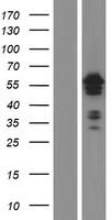 ETS1 / ETS-1 Protein - Western validation with an anti-DDK antibody * L: Control HEK293 lysate R: Over-expression lysate