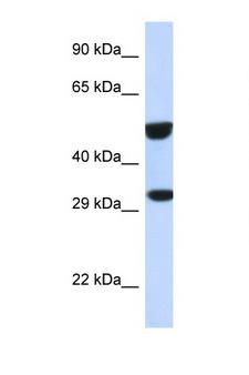 ETS2 Antibody - ETS2 antibody Western blot of 293T Cell lysate. Antibody concentration 1 ug/ml.  This image was taken for the unconjugated form of this product. Other forms have not been tested.
