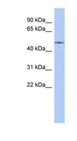 ETS2 Antibody - ETS2 antibody Western blot of Fetal Kidney lysate. This image was taken for the unconjugated form of this product. Other forms have not been tested.