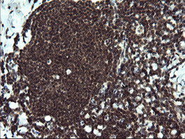 ETS2 Antibody - IHC of paraffin-embedded Human tonsil using anti-ETS2 mouse monoclonal antibody.