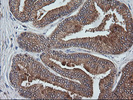 ETS2 Antibody - IHC of paraffin-embedded Human prostate tissue using anti-ETS2 mouse monoclonal antibody.