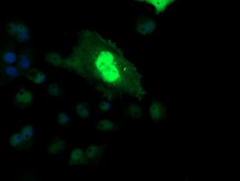 ETS2 Antibody - Anti-ETS2 mouse monoclonal antibody immunofluorescent staining of COS7 cells transiently transfected by pCMV6-ENTRY ETS2.