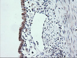 ETS2 Antibody - IHC of paraffin-embedded Human endometrium tissue using anti-ETS2 mouse monoclonal antibody.