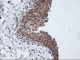 ETS2 Antibody - IHC of paraffin-embedded Human bladder tissue using anti-ETS2 mouse monoclonal antibody.