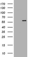 ETS2 Antibody - HEK293T cells were transfected with the pCMV6-ENTRY control (Left lane) or pCMV6-ENTRY ETS2 (Right lane) cDNA for 48 hrs and lysed. Equivalent amounts of cell lysates (5 ug per lane) were separated by SDS-PAGE and immunoblotted with anti-ETS2.