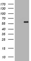 ETS2 Antibody - HEK293T cells were transfected with the pCMV6-ENTRY control (Left lane) or pCMV6-ENTRY ETS2 (Right lane) cDNA for 48 hrs and lysed. Equivalent amounts of cell lysates (5 ug per lane) were separated by SDS-PAGE and immunoblotted with anti-ETS2.