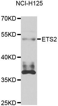 ETS2 Antibody - Western blot analysis of extracts of NCL-H125 cells.