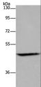 ETS2 Antibody - Western blot analysis of Mouse brain tissue, using ETS2 Polyclonal Antibody at dilution of 1:500.