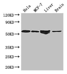 ETS2 Antibody - Western Blot Positive WB detected in: Hela whole cell lysate, MCF-7 whole cell lysate, Mouse liver tissue, Mouse brain tissue All lanes: ETS2 antibody at 2.7µg/ml Secondary Goat polyclonal to rabbit IgG at 1/50000 dilution Predicted band size: 54 kDa Observed band size: 54 kDa