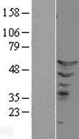 ETS2 Protein - Western validation with an anti-DDK antibody * L: Control HEK293 lysate R: Over-expression lysate