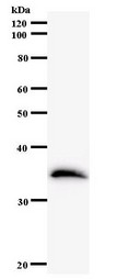 ETV3 Antibody - Western blot of immunized recombinant protein using ETV3 antibody.