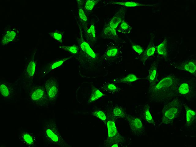 ETV3 Antibody - Immunofluorescence staining of ETV3 in U251MG cells. Cells were fixed with 4% PFA, permeabilzed with 0.1% Triton X-100 in PBS, blocked with 10% serum, and incubated with rabbit anti-Human ETV3 polyclonal antibody (dilution ratio 1:200) at 4°C overnight. Then cells were stained with the Alexa Fluor 488-conjugated Goat Anti-rabbit IgG secondary antibody (green). Positive staining was localized to Nucleus.