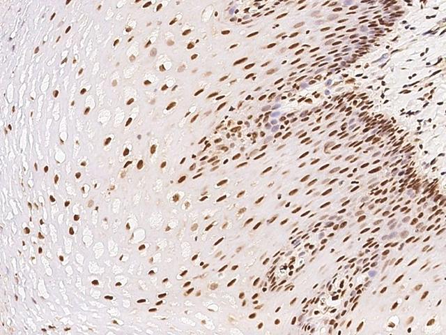 ETV3 Antibody - Immunochemical staining of human ETV3 in human esophagus with rabbit polyclonal antibody at 1:100 dilution, formalin-fixed paraffin embedded sections.