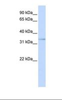 ETV3L Antibody - Jurkat cell lysate. Antibody concentration: 1.0 ug/ml. Gel concentration: 12%.  This image was taken for the unconjugated form of this product. Other forms have not been tested.