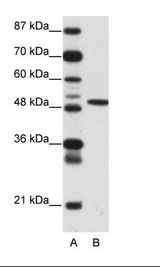 ETV5 / ERM Antibody - A: Marker, B: 293T Cell Lysate.  This image was taken for the unconjugated form of this product. Other forms have not been tested.