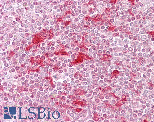 ETV5 / ERM Antibody - Anti-ETV5 antibody IHC of human spleen. Immunohistochemistry of formalin-fixed, paraffin-embedded tissue after heat-induced antigen retrieval. Antibody concentration 5 ug/ml.  This image was taken for the unconjugated form of this product. Other forms have not been tested.