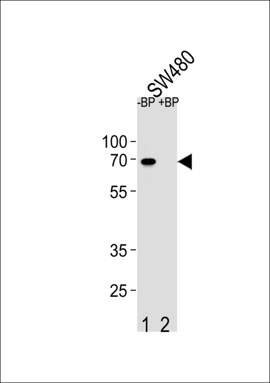 ETV5 / ERM Antibody - Western blot of ETV5 Antibody antibody pre-incubated without(lane 1) and with(lane 2) blocking peptide in SW480 cell line lysate. ETV5 Antibody (arrow) was detected using the purified antibody.